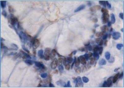 Immunohistochemistry-Paraffin RIP140 Antibody