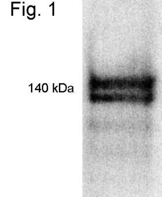 Western Blot RIP140 Antibody