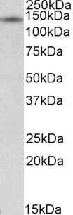 Western Blot: RIP140 Antibody [NBP1-36750] - Analysis of RIP140 in Human Cerebellum lysate (35ug protein in RIPA buffer) using NBP1-36750 at 0.5ug/ml. Primary incubation was 1 hour. Detected by chemiluminescence.