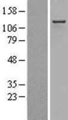 Western Blot: RIP140 Overexpression Lysate (Adult Normal) [NBL1-13793] Left-Empty vector transfected control cell lysate (HEK293 cell lysate); Right -Over-expression Lysate for RIP140.