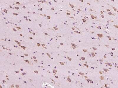Immunohistochemistry-Paraffin: RIP5 Antibody [NBP2-97564] - Immunochemical staining of human RIP5 in human brain with rabbit polyclonal antibody at 1:200 dilution, formalin-fixed paraffin embedded sections.