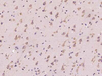 Immunohistochemistry-Paraffin: RIP5 Antibody [NBP2-99509] - Immunochemical staining of human RIP5 in human brain with rabbit polyclonal antibody at 1:200 dilution, formalin-fixed paraffin embedded sections.