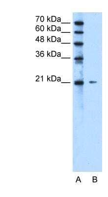 Western Blot: RIP5 Antibody [NBP1-91332] - Titration: 2.5ug/ml Positive Control: Jurkat cell lysate.