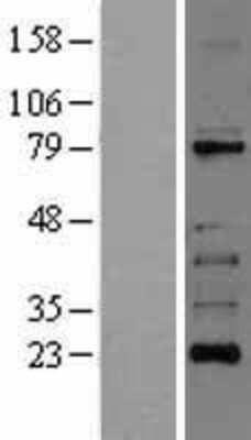 Western Blot RIPK1/RIP1 Overexpression Lysate