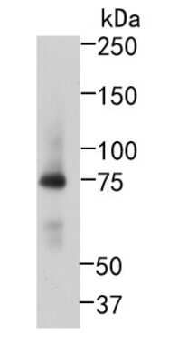 Western Blot: RIPK1/RIP1 Antibody (JJ092-08) [NBP2-67905] - Western blot analysis of RIPK1/RIP1 on Raji cells lysates using anti-RIPK1/RIP1 antibody at 1/500 dilution.