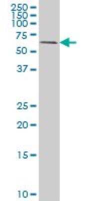 Western Blot: RIPK2 Antibody (7F5) [H00008767-M05] - Analysis of RIPK2 expression in HeLa (Cat # L013V1).