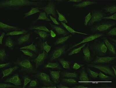 Immunocytochemistry/Immunofluorescence: RIPK2 Antibody [H00008767-D01P] - Analysis of antibody to RIPK2 on HeLa cell. Antibody concentration 10 ug/ml.