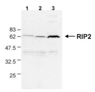 Western Blot: RIPK2 Antibody (Nick-1) [NBP1-97631] - Detection of endogenous human RIP2 in different human cell lines by the MAb to RIP2 (Nick-1). Method: Total cell extracts (50ug) from Jurkat (lane1), THP-1 (lane 2) and HT1080 (lane 3) cell ljnes were run on a SDS-gel, and revealed with MAb to RIP2 (Nick-1) (1:1000 in 5% milk powder) for 1 hour at rooom temperature followed by incubation with HRP-coupled anti-rat secondary antibody (1:4000).