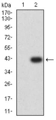 Western Blot: RIPK4 Antibody (1F7D9) [NBP2-61860] - Analysis using RIPK4 mAb against HEK293 (1) and RIPK4 (AA: 675-784)-hIgGFc transfected HEK293 (2) cell lysate.