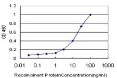 Sandwich ELISA: RIPK4 Antibody (1G2) [H00054101-M02] - Detection limit for recombinant GST tagged RIPK4 is approximately 0.3ng/ml as a capture antibody.