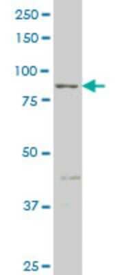 Western Blot: RIPK4 Antibody (1G2) [H00054101-M02] - RIPK4 monoclonal antibody (M02), clone 1G2 Analysis of RIPK4 expression in HepG2.