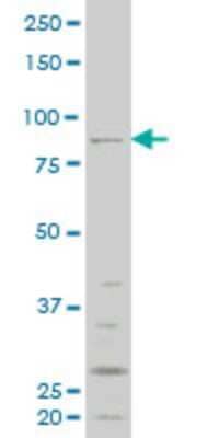 Western Blot: RIPK4 Antibody (3B1) [H00054101-M03] - Analysis of RIPK4 expression in HepG2 (Cat # L019V1).