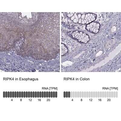 <b>Orthogonal Strategies Validation. </b>Immunohistochemistry-Paraffin: RIPK4 Antibody [NBP2-62605] - Immunohistochemistry analysis in human esophagus and colon tissues using Anti-RIPK4 antibody. Corresponding RIPK4 RNA-seq data are presented for the same tissues.