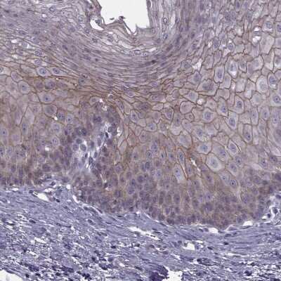 Immunohistochemistry-Paraffin: RIPK4 Antibody [NBP2-62605] - Staining of human esophagus shows high expression.