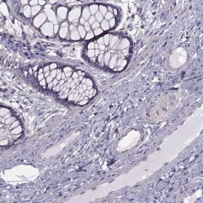 Immunohistochemistry-Paraffin: RIPK4 Antibody [NBP2-62605] - Staining of human colon shows low expression as expected.