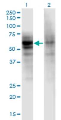 Western Blot: RIPK5 Antibody (1F9) [H00025778-M06] - Analysis of DSTYK expression in transfected 293T cell line by DSTYK monoclonal antibody (M06), clone 1F9. Lane 1: DSTYK transfected lysate (Predicted MW: 66.4 KDa). Lane 2: Non-transfected lysate.