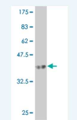 Western Blot: RIPK5 Antibody (4B3) [H00025778-M07] - Detection against Immunogen (37.84 KDa) .