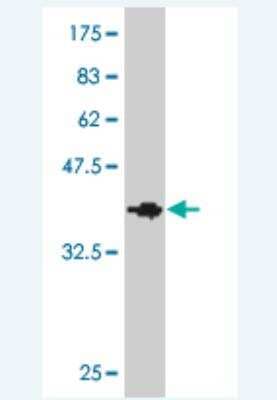 Western Blot: RIPK5 Antibody (4F3) [H00025778-M03] -  Detection against Immunogen (37.84 KDa) .