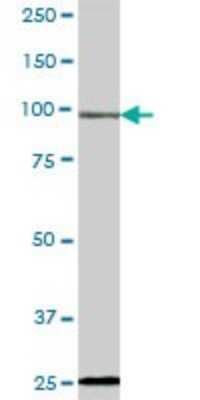 Western Blot: RIPK5 Antibody [H00025778-B01P] - Analysis of DSTYK expression in human stomach.