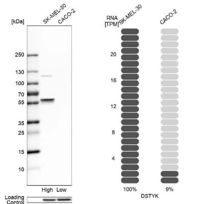 Western Blot RIPK5 Antibody