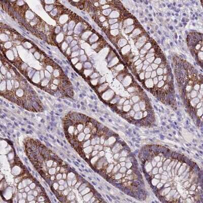Immunohistochemistry-Paraffin: RIPPLY2 Antibody [NBP2-33489] - Staining of human rectum shows strong granular cytoplasmic positivity in glandular cells.