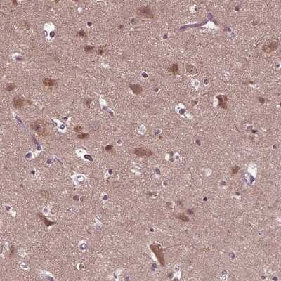 Immunohistochemistry-Paraffin: RIPX Antibody [NBP1-89614] - Staining of human cerebral cortex shows moderate cytoplasmic positivity in neuronal cells.