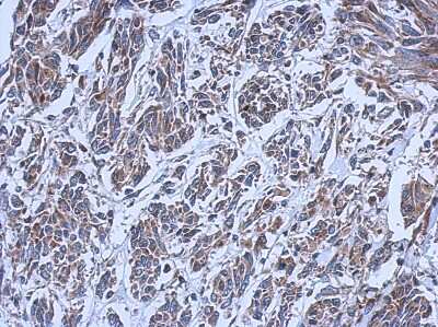 Immunohistochemistry-Paraffin: RIPX Antibody [NBP2-20168] - Immunohistochemical analysis of paraffin-embedded U251 xenograft, using antibody at 1:500 dilution.