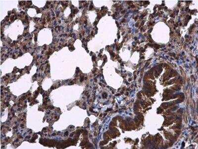 Immunohistochemistry-Paraffin: RIPX Antibody [NBP2-20168] - Paraffin-embedded mouse lung. RIPX antibody [N1C1] diluted at 1:500.