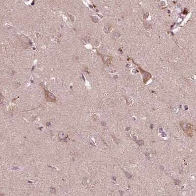 Immunohistochemistry-Paraffin: RIPX Antibody [NBP2-48558] - Staining of human cerebral cortex shows high expression.