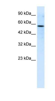 Western Blot: RIPX Antibody [NBP1-80039] - Titration: 0.2-1 ug/ml, Positive Control: Jurkat cell lysate.