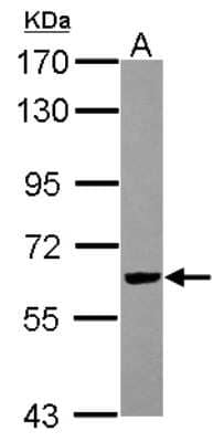 Western Blot: RIPX Antibody [NBP2-20168] - Sample (30 ug of whole cell lysate) A: IMR32 7. 5% SDS PAGE gel, diluted at 1:3000.