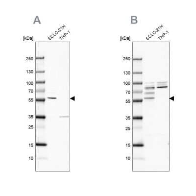 Western Blot RIPX Antibody - BSA Free