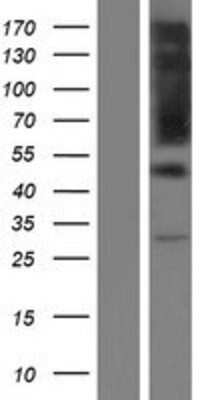 Western Blot RIPX Overexpression Lysate