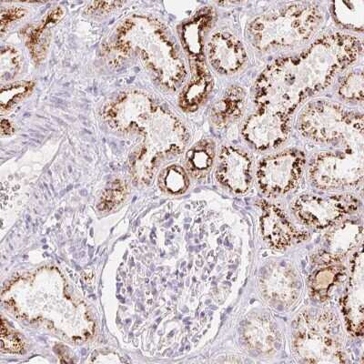 Immunohistochemistry: RISC Antibody [NBP2-49250] - Staining of human kidney shows strong granular cytoplasmic positivity in cells in tubules.