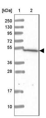 Western Blot: RISC Antibody [NBP1-87127] - Lane 1: Marker  [kDa] 250, 130, 95, 72, 55, 36, 28, 17, 10.  Lane 2: Human cell line RT-4