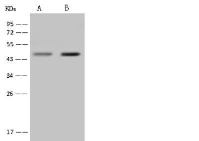 Western Blot: RISC Antibody [NBP2-97783] - Anti-RISC rabbit polyclonal antibody at 1:500 dilution. Lane A: A431 Whole Cell Lysate. Lane B: U-251 MG Whole Cell Lysate. Lysates/proteins at 30 ug per lane. Secondary Goat Anti-Rabbit IgG (H+L)/HRP at 1/10000 dilution. Developed using the ECL technique. Performed under reducing conditions. Predicted band size: 51 kDa