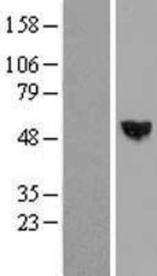 Western Blot: RISC Overexpression Lysate (Adult Normal) [NBL1-15750] Left-Empty vector transfected control cell lysate (HEK293 cell lysate); Right -Over-expression Lysate for RISC.