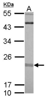 Western Blot: RIT1 Antibody [NBP2-20169] - Sample (30 ug of whole cell lysate) A: A431 12% SDS PAGE gel, diluted at 1:1000.