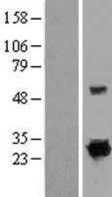 Western Blot: RIT1 Overexpression Lysate (Adult Normal) [NBP2-07557] Left-Empty vector transfected control cell lysate (HEK293 cell lysate); Right -Over-expression Lysate for RIT1.