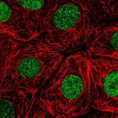Immunocytochemistry/ Immunofluorescence RITA Antibody - BSA Free