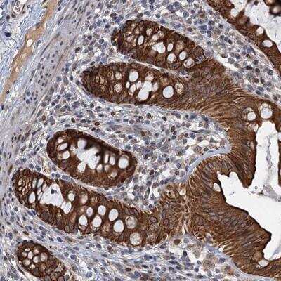 Immunohistochemistry: RITA Antibody [NBP1-94003] - Staining of human rectum shows strong cytoplasmic and membranous positivity in glandular cells.
