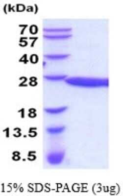 SDS-Page: RKIP/PBP Recombinant Protein [NBP2-52174] - 15% SDS Page (3 ug)