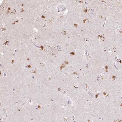 Immunohistochemistry: RLBP1L1 Antibody [NBP2-47508] - Staining of human lateral ventricle shows strong cytoplasmic positivity in neuronal cells.