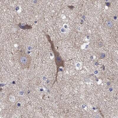 Immunohistochemistry-Paraffin: RLBP1L1 Antibody [NBP3-17925] - Staining of human cerebral cortex shows moderate cytoplasmic positivity in neurons.