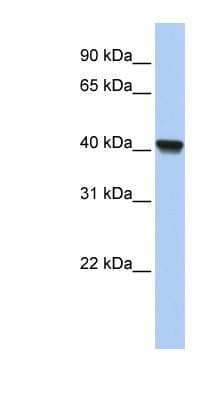 Western Blot: RLBP1L1 Antibody [NBP1-55291] - Human Lung lysate, concentration 0.2-1 ug/ml.