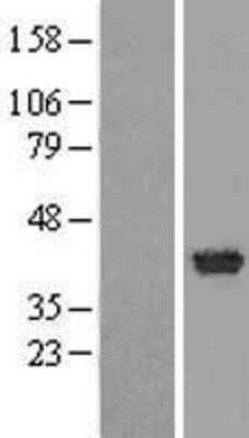 Western Blot: RLBP1L1 Overexpression Lysate (Adult Normal) [NBL1-15384] Left-Empty vector transfected control cell lysate (HEK293 cell lysate); Right -Over-expression Lysate for RLBP1L1.