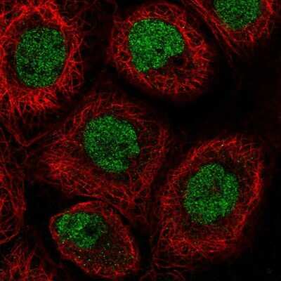 Immunocytochemistry/Immunofluorescence: RLF Antibody [NBP2-56166] - Staining of human cell line A-431 shows localization to nucleus & nucleoli.