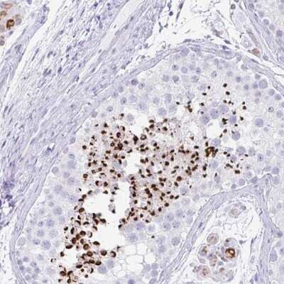 Immunohistochemistry-Paraffin RLF Antibody