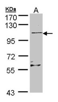 Western Blot RLF Antibody