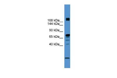 Western Blot: RLF Antibody [NBP3-10493] - Western blot analysis using NBP3-10493 on Human PANC1 as a positive control. Antibody Titration: 0.2-1 ug/ml